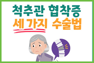 척추관 협착증 세 가지 수술 방법