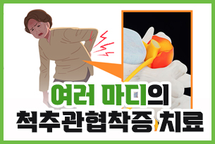 여러 마디 척추관협착증 치료에 효과적인 수술