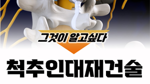 척추인대재건술, 꼭 해야 할까?
