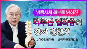 냉동사체 해부로 밝혀진, 척추관 협착증의 원인?!